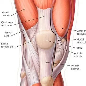 Medical illustration of a knee seen from the front, labeling the quadriceps tendon, patella, iliotibial band, and surrounding muscles. A dark line traces the path of a traditional incision down through the quadriceps tendon.